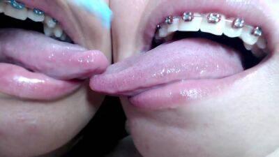 Deep tounge kissing between two brace lesbian on freereelz.com